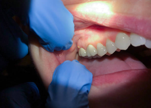 Best Pediatric Emergency Dentist in Whitinsville, MA