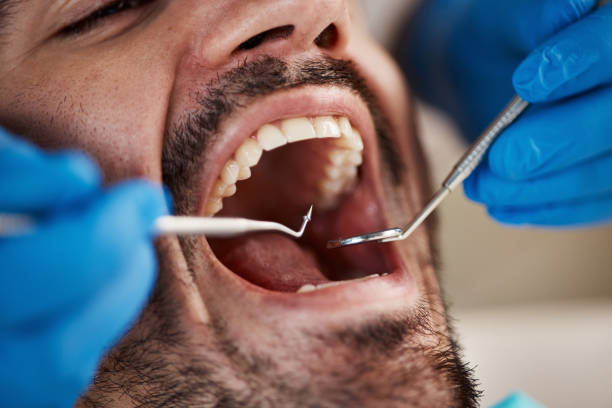Best Emergency TMJ Treatment in Whitinsville, MA
