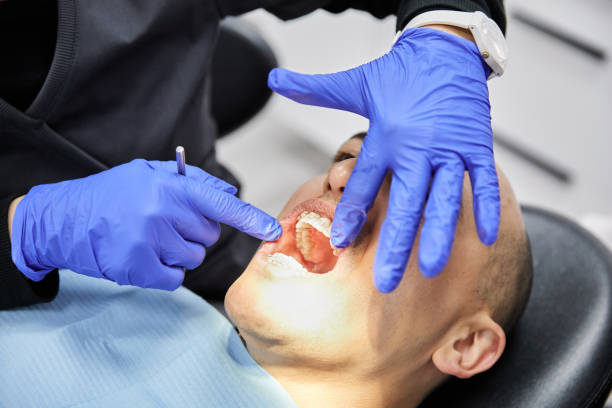 Best Emergency Tooth Extraction in Whitinsville, MA